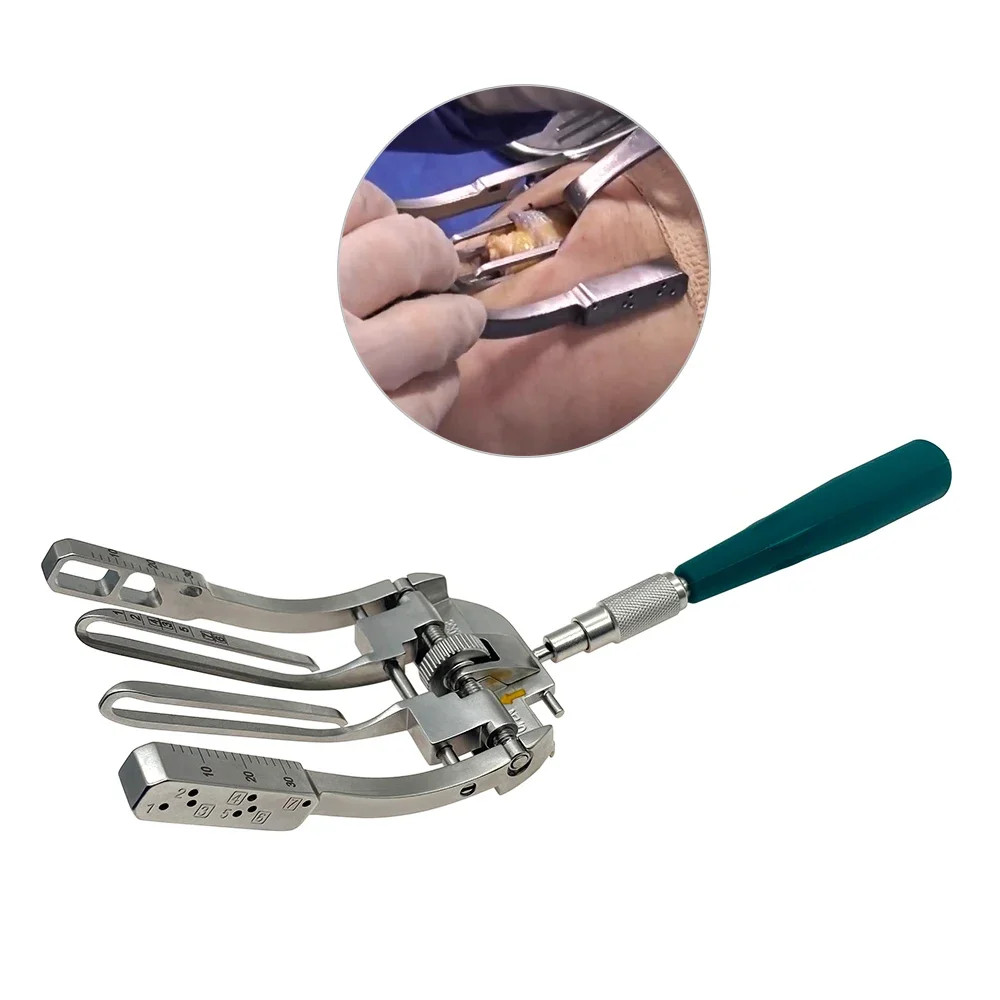 Percutaneous Quadriceps Achilles Tendon Ligment Repair Kit